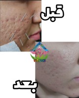 تصاویر 